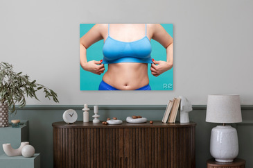 Woman in Blue Top Bra with Very Large Breasts, Plastic Surgery